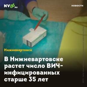     -  35 