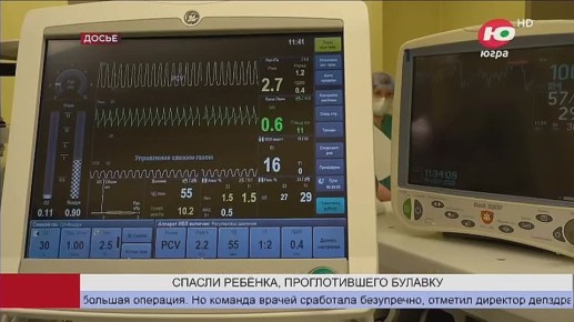 В Сургуте спасли ребёнка, проглотившего булавку