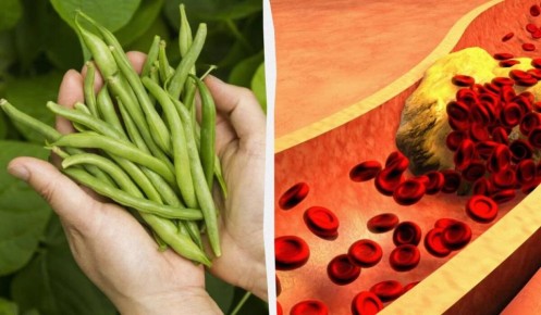 Овощ, который поможет снизить холестерин: все о зеленой фасоли