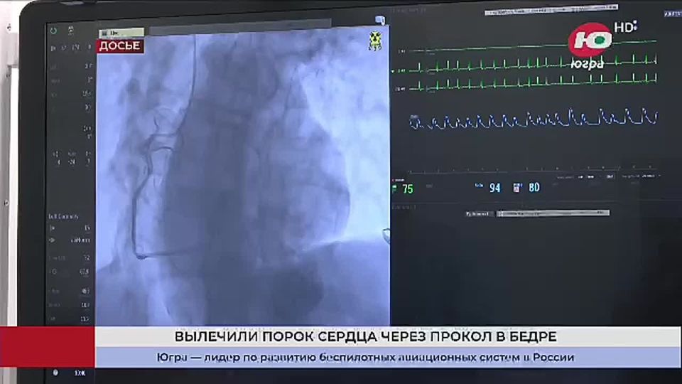 � ������� �������� ����� ������ ����� ������ � �����